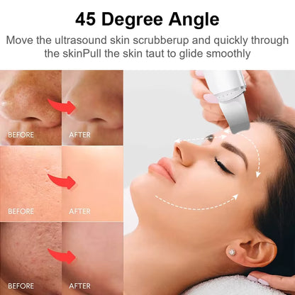 EclatSkin Plus™